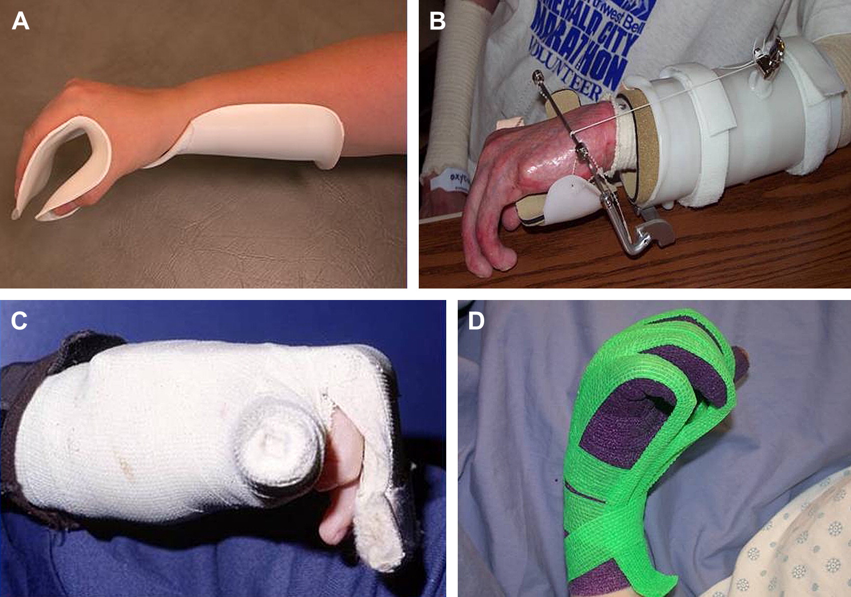 العلاج الطبيعي للمفاصل والعظام في فزيو ميد